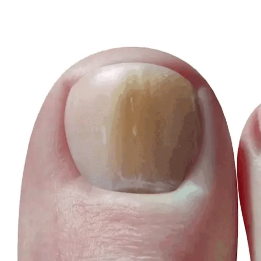 GONNA WAY (REPARADOR DE UÑAS)