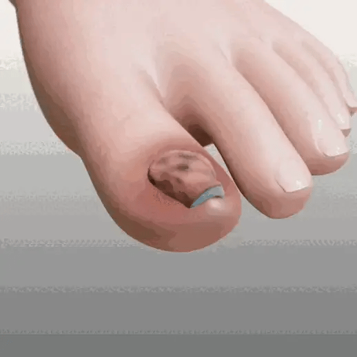 GONNA WAY (REPARADOR DE UÑAS)